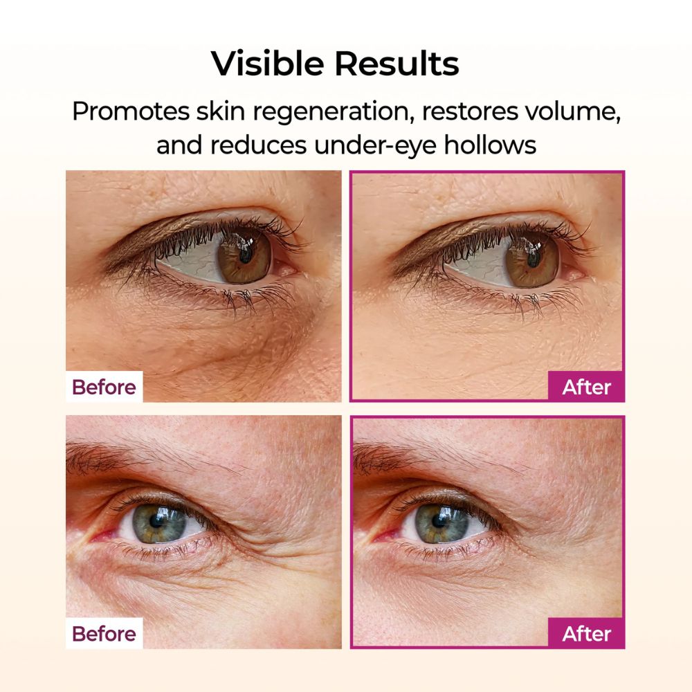 Dr.Melaxin Cemenrete Calcium Volume Multi Balm